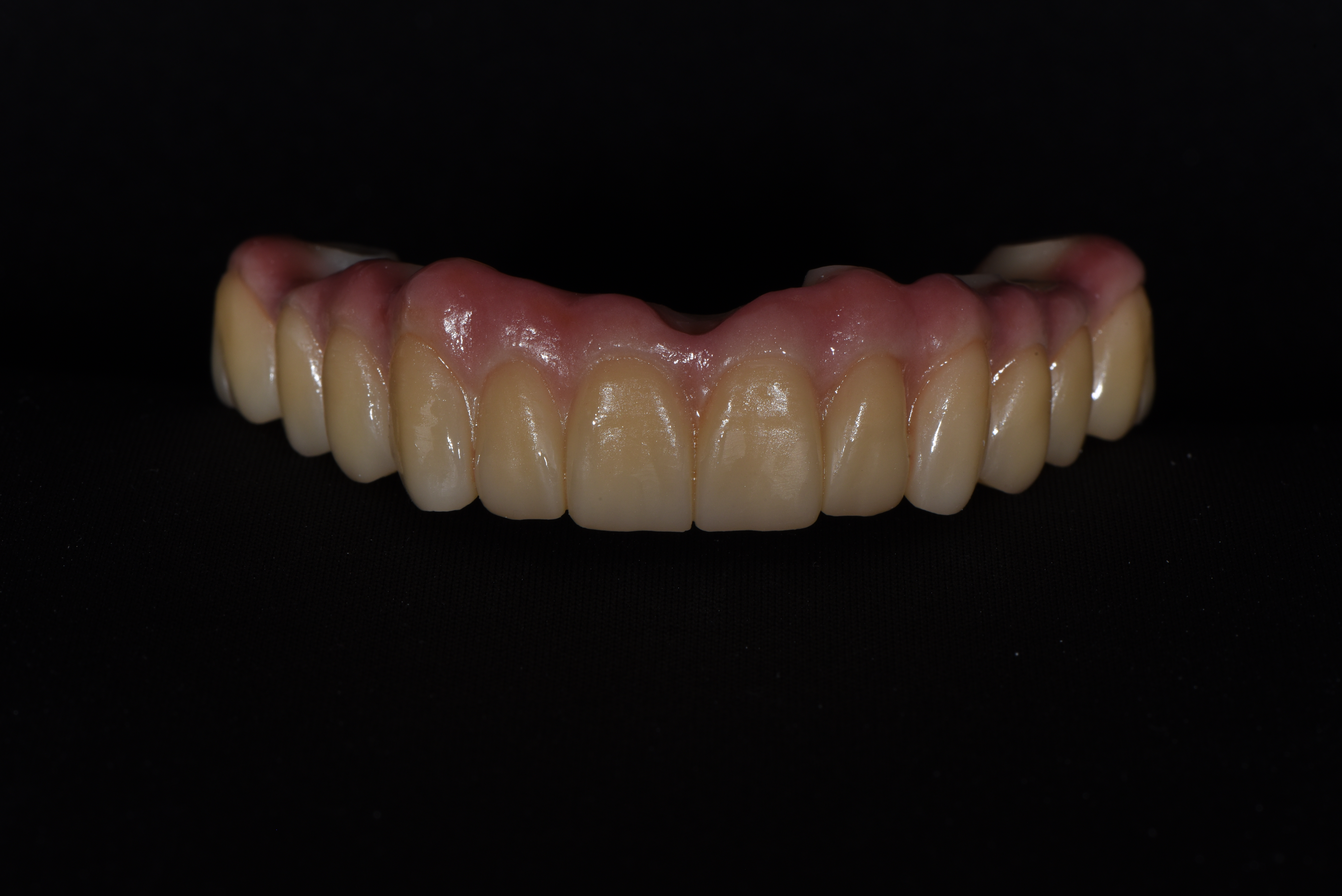 Plate 001 — prosthetic work