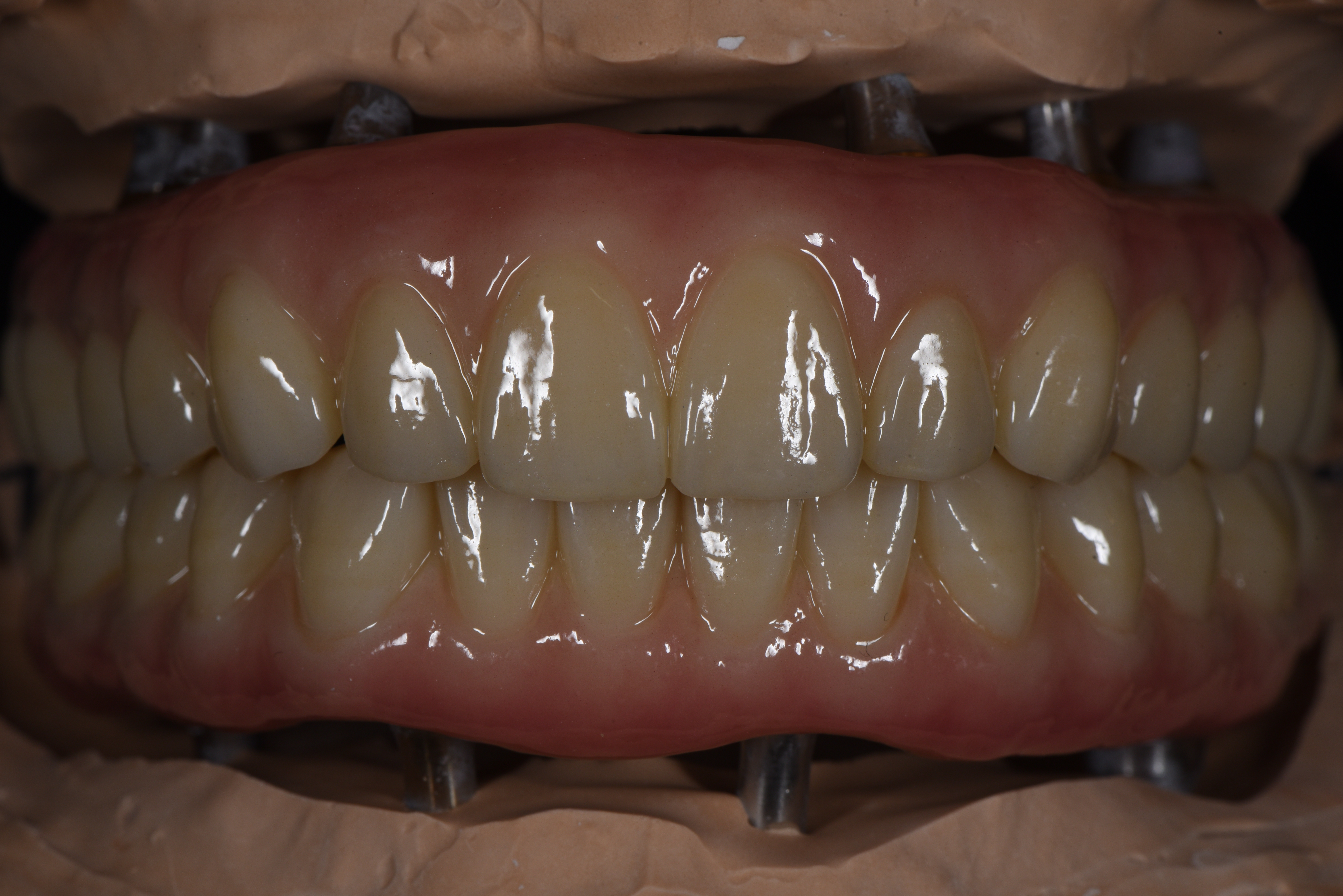 Plate 003 — prosthetic work