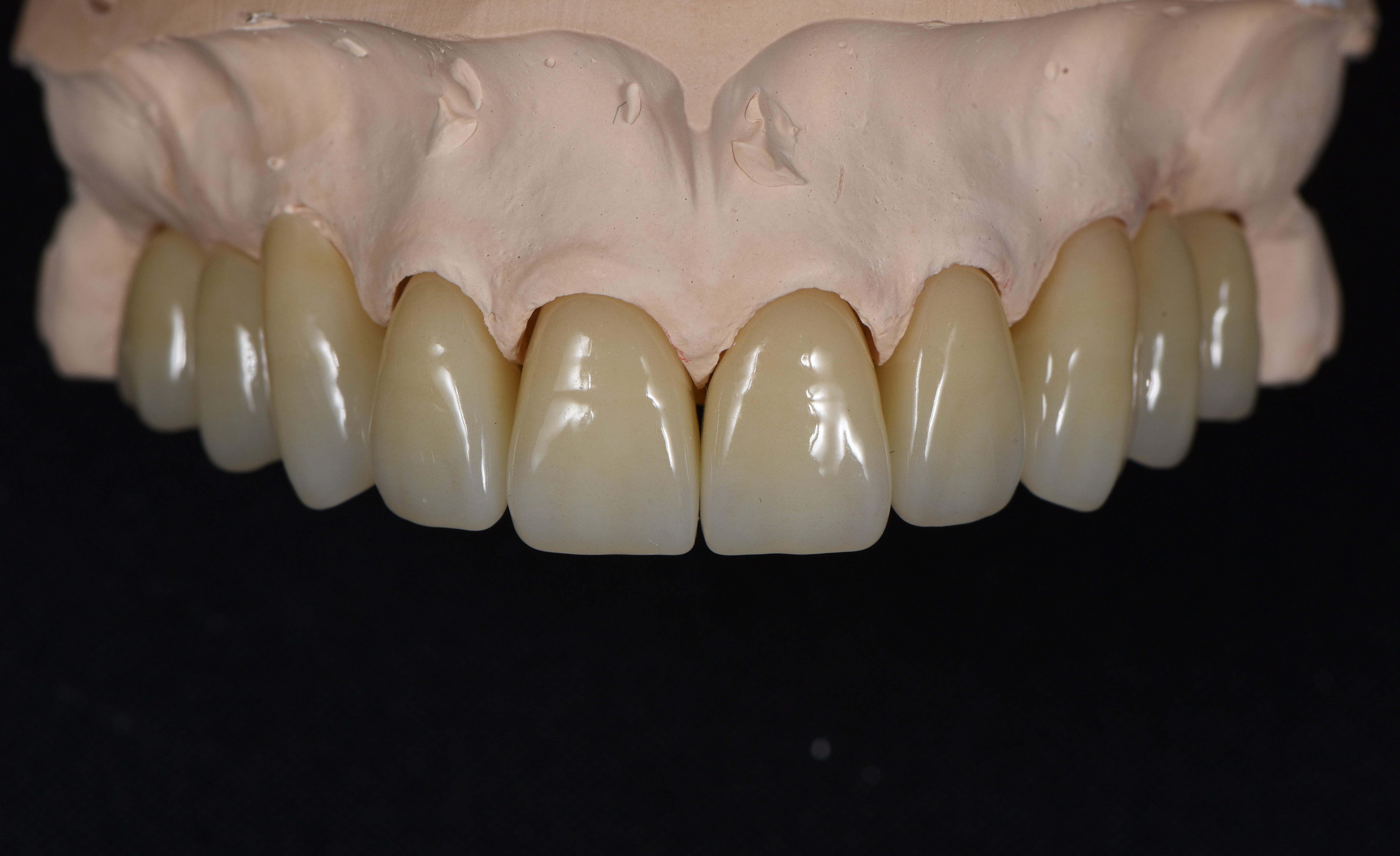 Plate 005 — prosthetic work